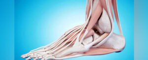 Lee más sobre el artículo Descubren un ligamento en el tobillo que no está en los manuales de anatomía