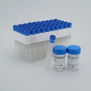 Envases con formol para muestras histológicas Casa Álvarez