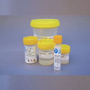 Casa Alvarez containers with formaldehyde for histology samples