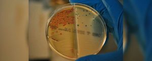 Nueva estrategia para frenar las resistencias a los antibióticos