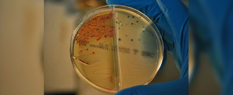 Lee más sobre el artículo Nueva estrategia para frenar las resistencias a los antibióticos