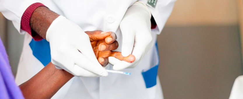 Anuncian la cura de una mujer con VIH tras un trasplante de células madre de cordón umbilical