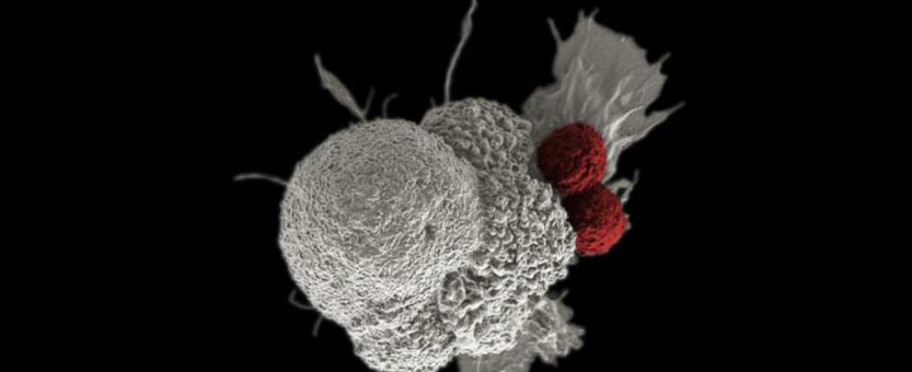 ¿Células T reprogramadas para acabar con las enfermedades autoinmunes?