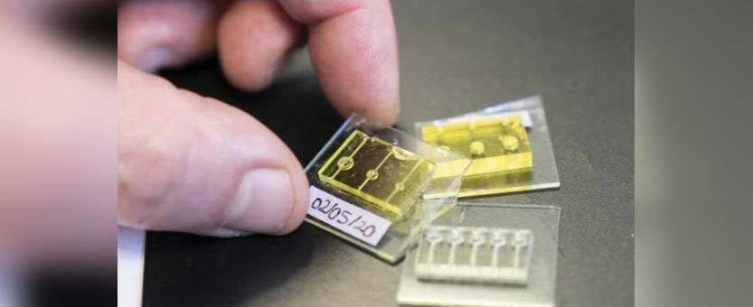 Micrometric blood plasma separator manufactured by 3D printing