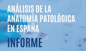 Lee más sobre el artículo Informe Análisis de la Anatomía Patológica en España